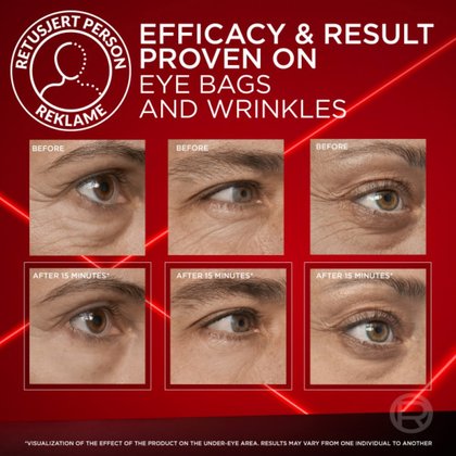 Eye Eraser Retouch NO